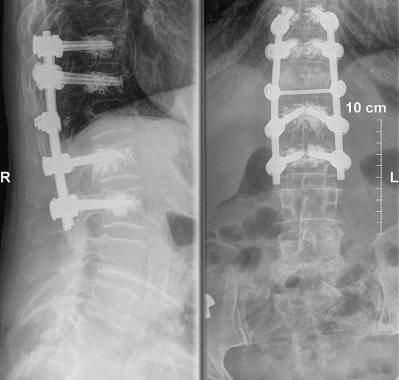 chirurgia podstawy czaszki