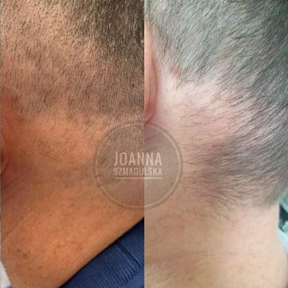 zabiegi medycyny estetycznej