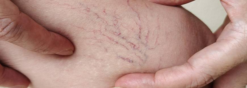 Prywatny Gabinet Chirurgiczny lek. Piotr Stabiszewski