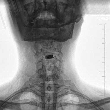 specjalista nerochirurgii