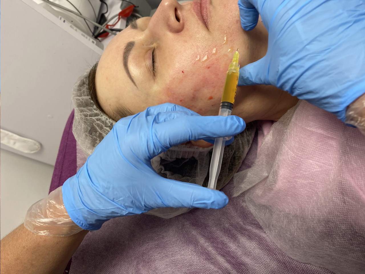 zabiegi medycyny estetycznej