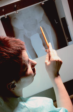 angiologia, chirurg naczyniowy, owrzodzenia żylne, miażdżyca, żylaki, USG