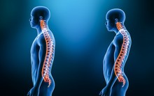 problemy z kręgosłupem