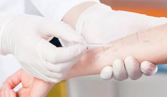 alergolog dziecięcy