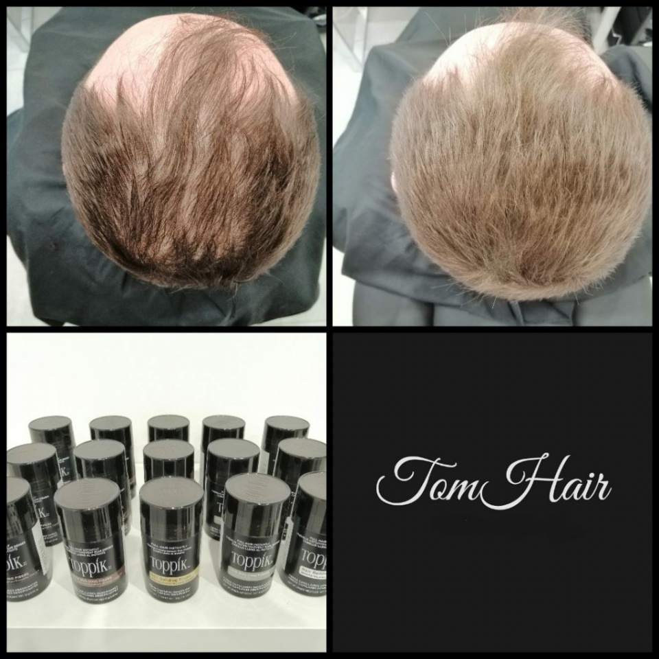 mikropigmentacja skóry głowy