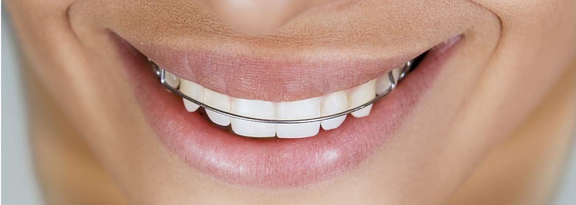 Mm Dent Stomatologia Ortodoncja