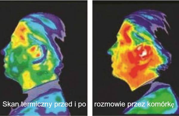 neutralizacja szkodliwego promieniowania