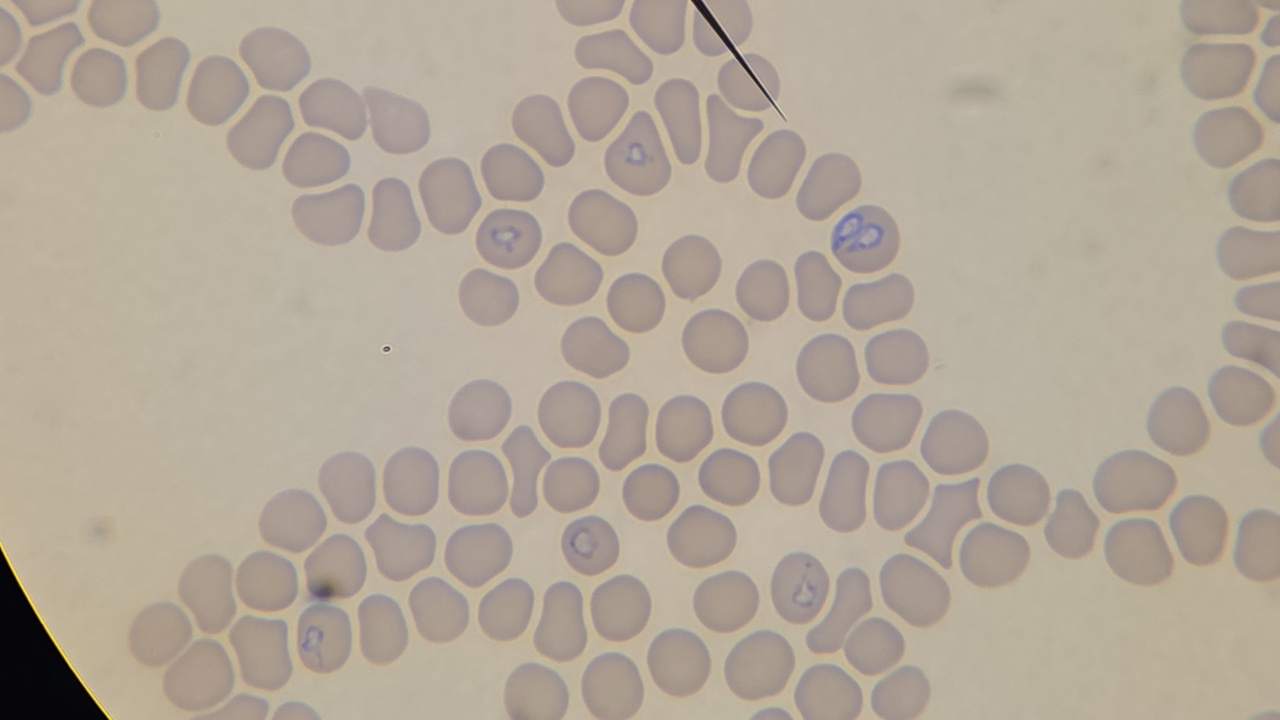 Babesia Canis - choroba odkleszczowa