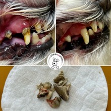 usuwanie kamienia nazębnego