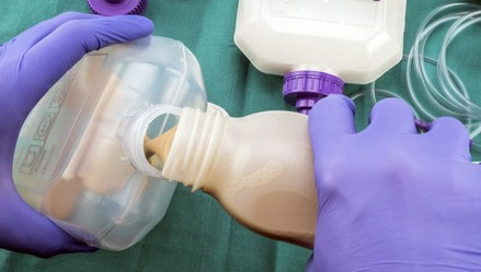 żywienie dojelitowe