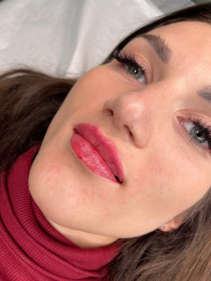 Modelowanie ust kwasem hialuronowym oraz makijaż permanentny ust