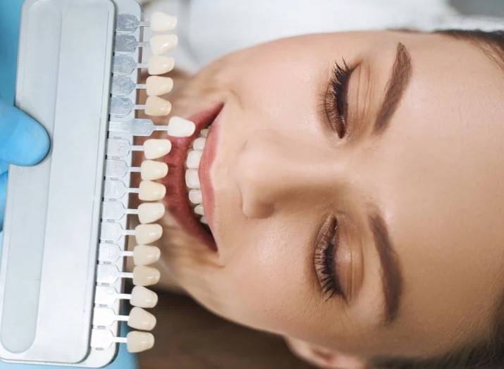 stomatologia estetyczna