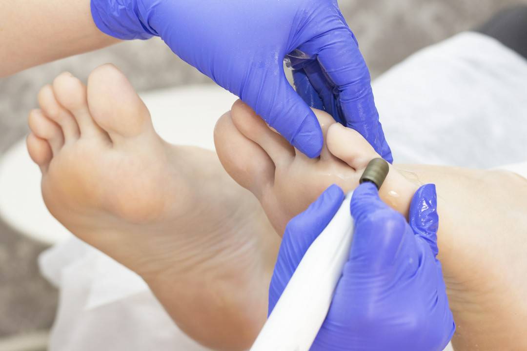 leczenie chorób stóp