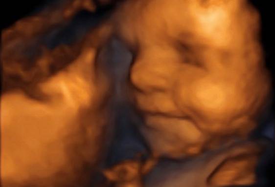 lekarz ginekolog, lekarz położnik, położnik, ginekologia estetyczna, ginekolog, choroby kobiece, Jacek Skórczewski Gabinet lekarski, Bydgoszcz