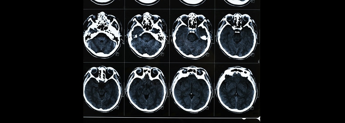 Indywidualna Specjalistyczna Praktyka Lekarska lek. med. Joanna Krupa-Olchawa