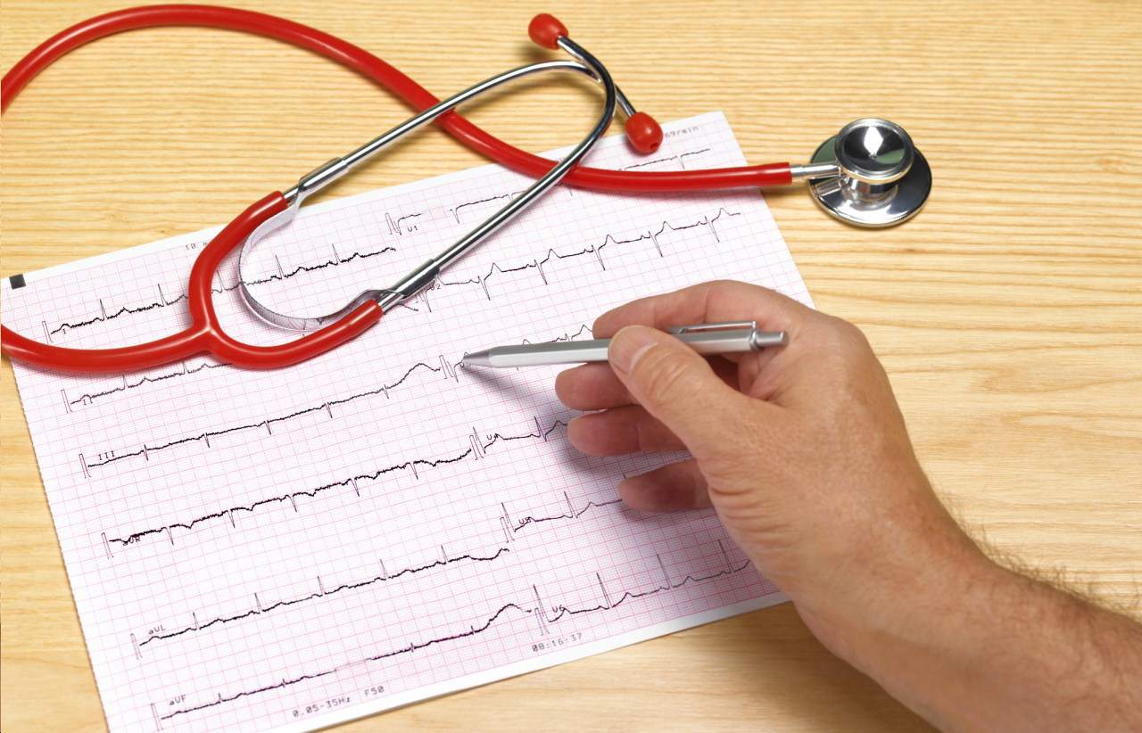 badanie kardiologiczne