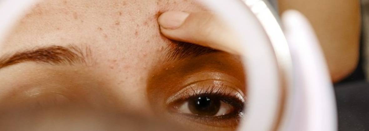 Światło Zdrowej Skóry Edyta Kapica