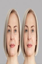 zabiegi odmładzające