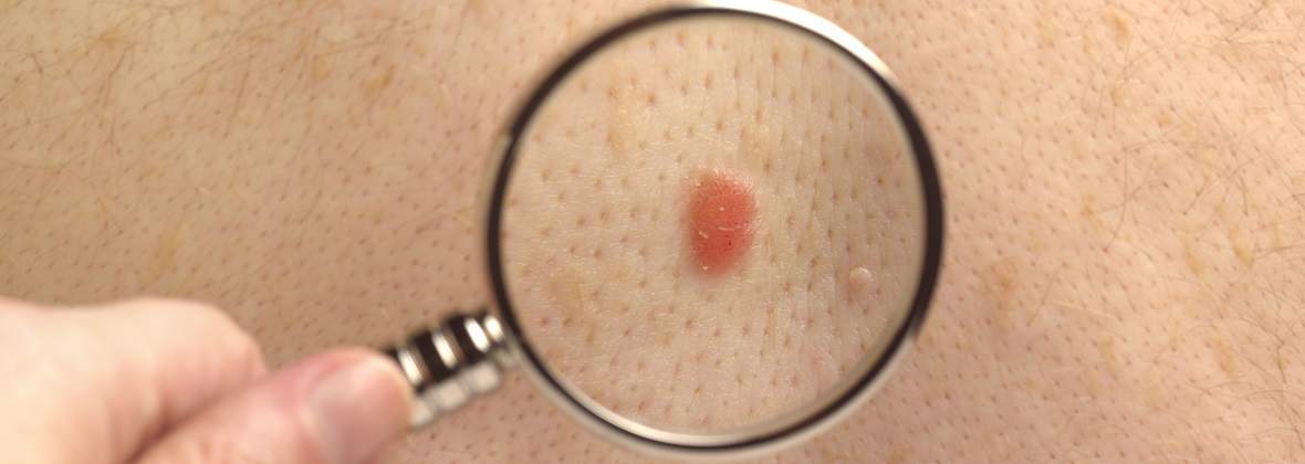 Prywatny Gabinet Dermatologiczny Elżbieta Kozłowska-Reszeć