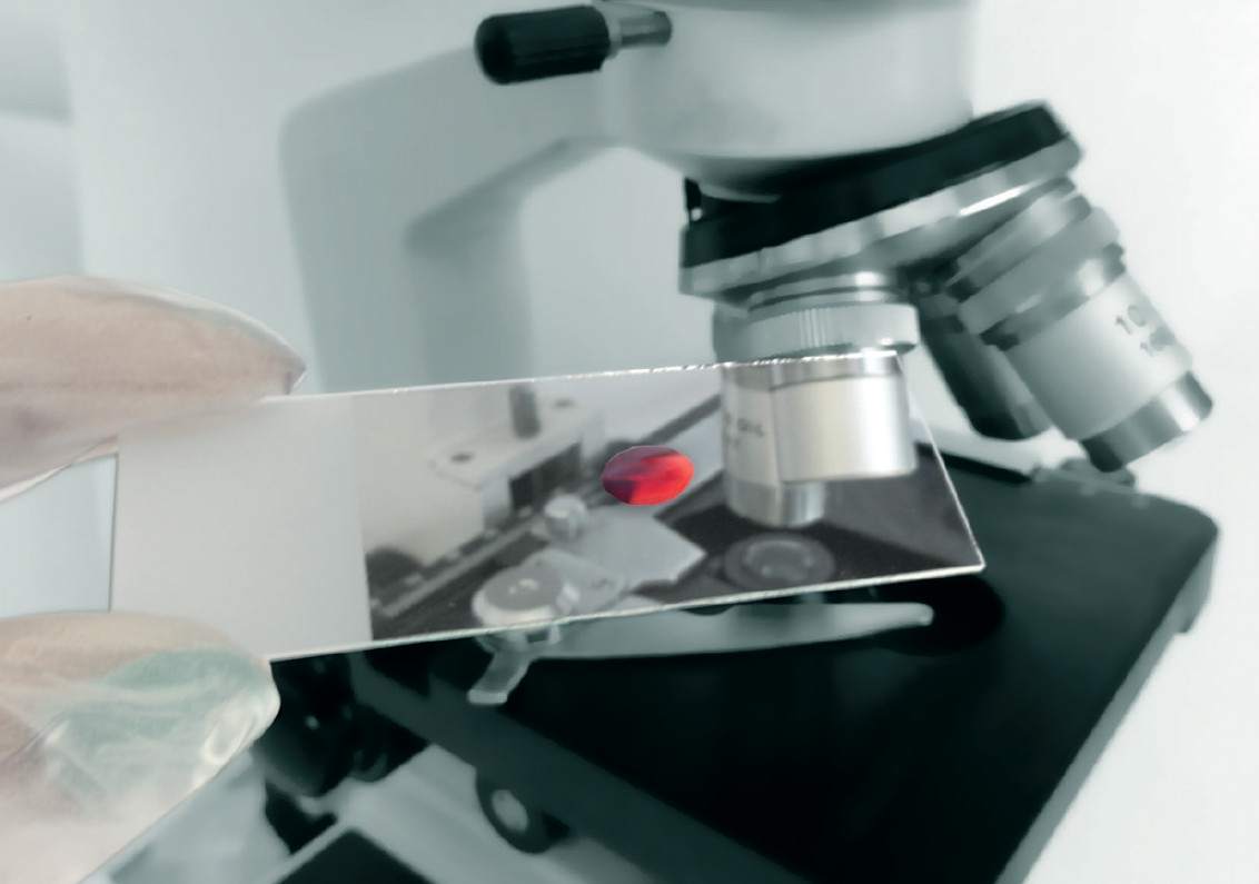 bezinwazyjne metody diagnostyczne, mikroskopowe badanie żywej kropli krwi