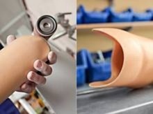 protezy kończyn górnych