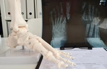 diagnostyka schorzeń układu narządów ruchu