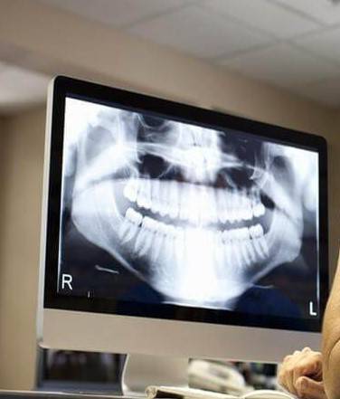 RTG zębów