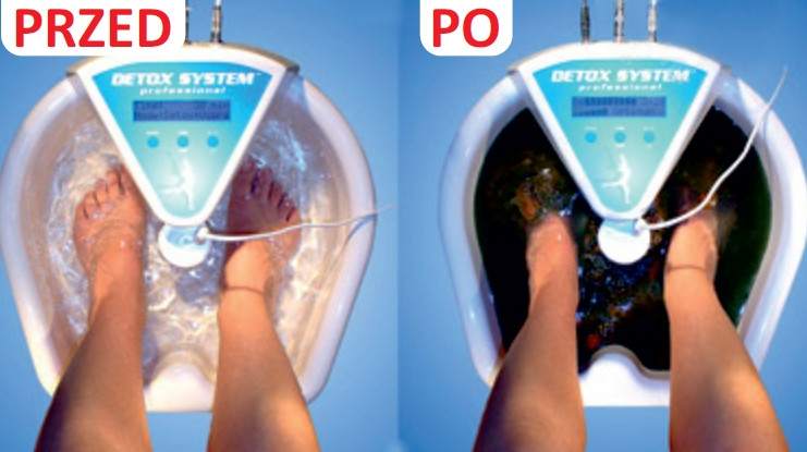 body detox, oczyszczanie krwi, usuwanie toksyn metali ciężkich