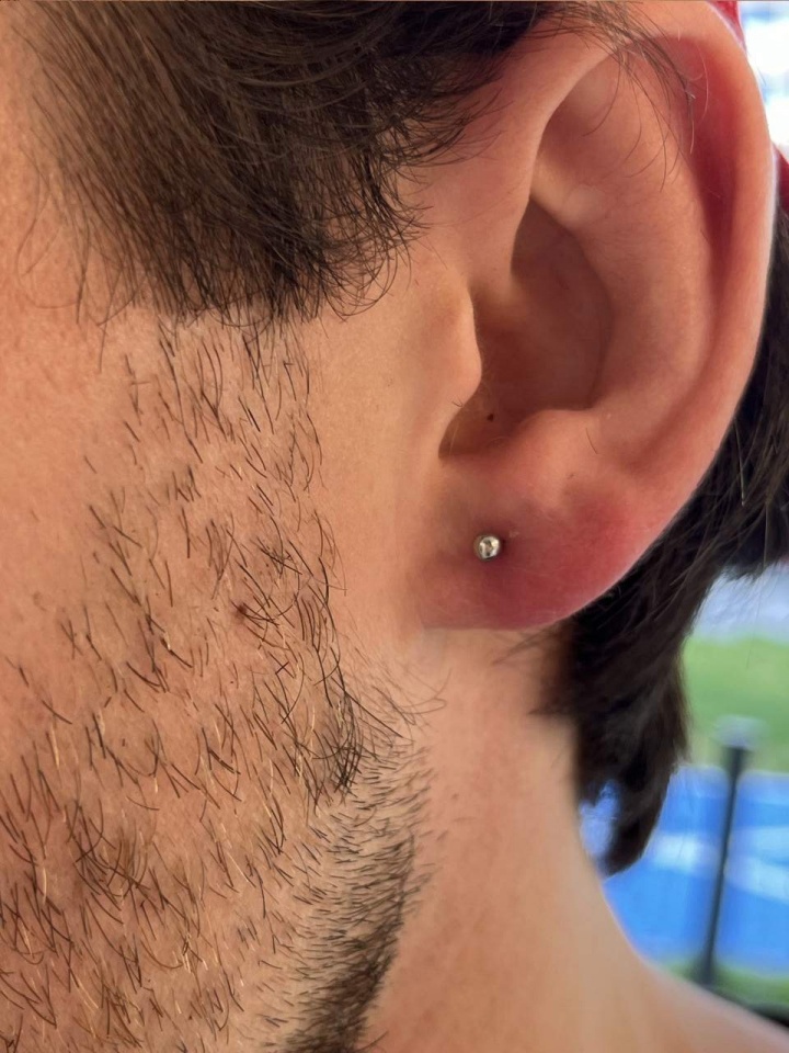 kolczyk w uchu