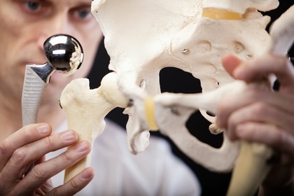 endoprotezoplastyka stawu biodrowego