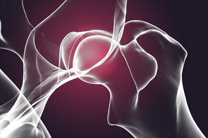 dysplazja stawów u psów