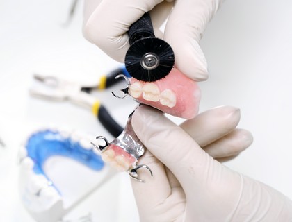 protetyka dentystyczna