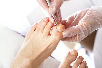 pedicure podologiczny